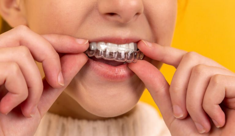 Twin Oak Dental Studio | Can Invisalign Fix Bite Problems? Twin Oak Dental Studio | Can Invisalign Fix Bite Problems?